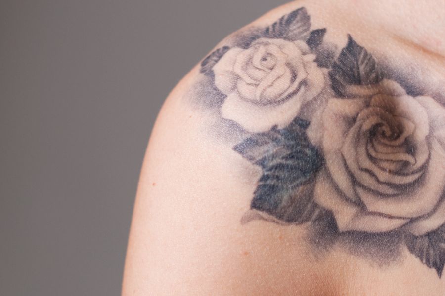 Rimozione di tatuaggi neri e scuri