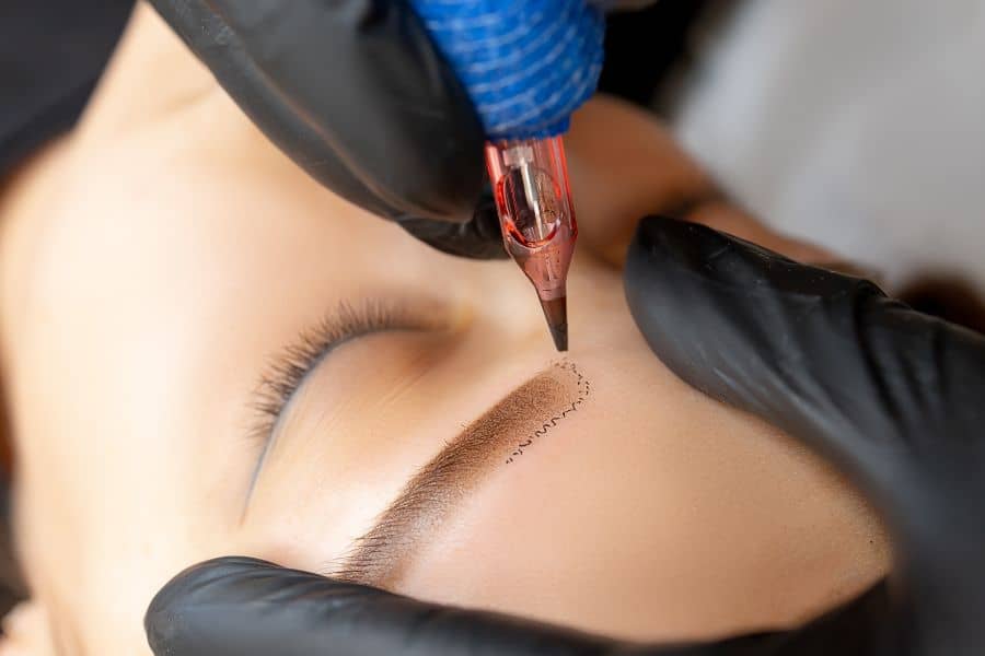 Rimozione Tatuaggi Cosmetici