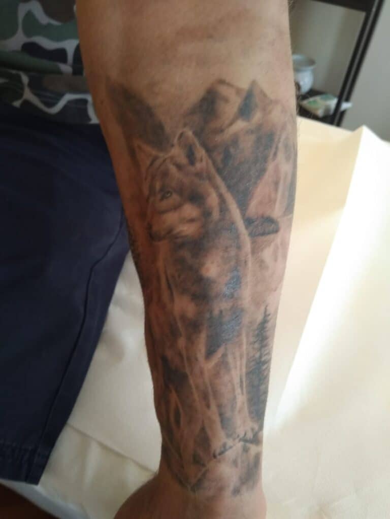 Tatuaggio nero sul braccio prima del trattamento laser a Brescia